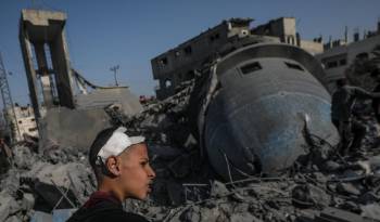 Un joven herido tras un ataque aéreo israelí en Deir Al Balah, sur de la Franja de Gaza, el 2 de marzo de 2024.
