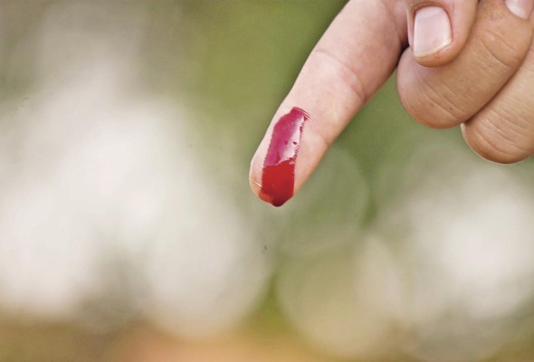 La hemofilia supone un desafío para los hombres que la padecen La hemofilia supone un desafío para los hombres que la padecen