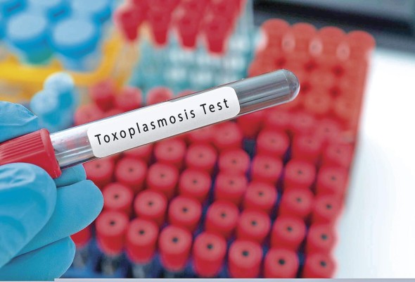 La toxoplasmosis es una infección producida por el parásito 'Toxoplasma gondii'. La toxoplasmosis es una infección producida por el parásito 'Toxoplasma gondii'.