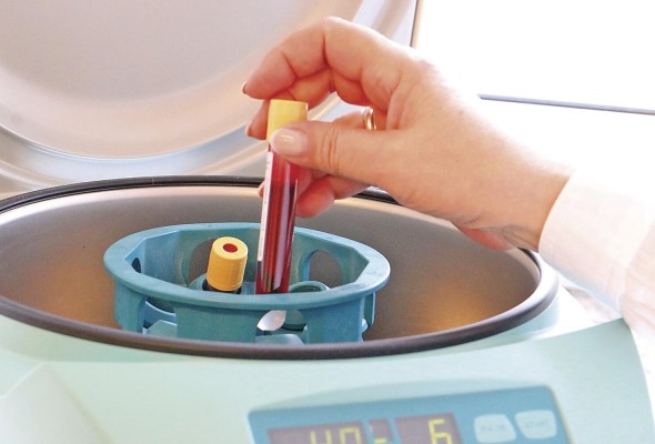 La ciencia sustenta la relevancia de que los padres se realicen una prueba de electroforesis de hemoglobina, que consiste en un análisis de sangre. La ciencia sustenta la relevancia de que los padres se realicen una prueba de electroforesis de hemoglobina, que consiste en un análisis de sangre.