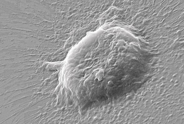 La imagen 'Nucleus of a PDMSC used in COVID19 Research', de Cindy Fu, mereció el segundo lugar del Top 20. La imagen 'Nucleus of a PDMSC used in COVID19 Research', de Cindy Fu, mereció el segundo lugar del Top 20.