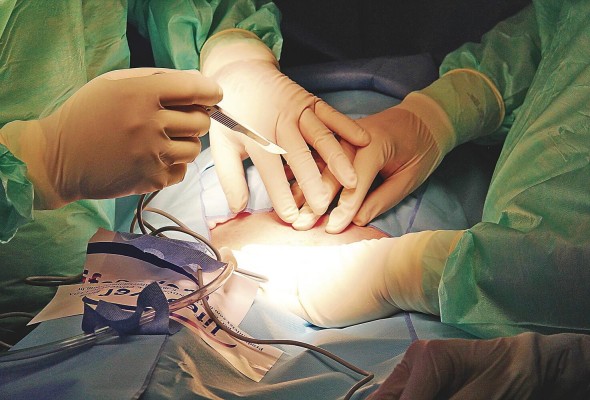 Al favorecer la pérdida de peso, esta intervención quirúrgica ayuda a que las relaciones sean más exitosas porque la autoestima aumenta de manera significativa. Al favorecer la pérdida de peso, esta intervención quirúrgica ayuda a que las relaciones sean más exitosas porque la autoestima aumenta de manera significativa.