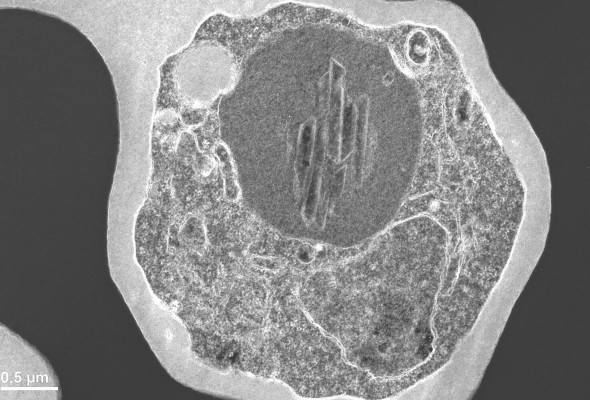 Microscopía en blanco y negro de un eritrocito infectado con el parásito 'P. falciparum' (gris más claro). En el parásito se ve la vacuola digestiva con el cristal de hemozoína adentro. Microscopía en blanco y negro de un eritrocito infectado con el parásito 'P. falciparum' (gris más claro). En el parásito se ve la vacuola digestiva con el cristal de hemozoína adentro.