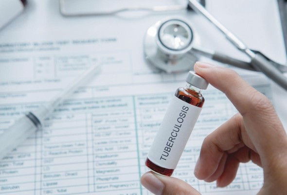 Vencer a la tuberculosis, un reto cada vez más difícil Vencer a la tuberculosis, un reto cada vez más difícil