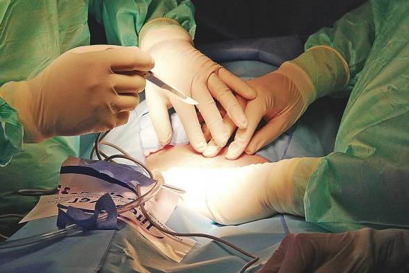 Al favorecer la pérdida de peso, esta intervención quirúrgica ayuda a que las relaciones sean más exitosas porque la autoestima aumenta de manera significativa. Al favorecer la pérdida de peso, esta intervención quirúrgica ayuda a que las relaciones sean más exitosas porque la autoestima aumenta de manera significativa.