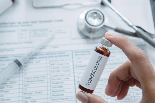 Vencer a la tuberculosis, un reto cada vez más difícil Vencer a la tuberculosis, un reto cada vez más difícil