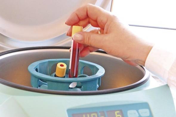 La ciencia sustenta la relevancia de que los padres se realicen una prueba de electroforesis de hemoglobina, que consiste en un análisis de sangre. La ciencia sustenta la relevancia de que los padres se realicen una prueba de electroforesis de hemoglobina, que consiste en un análisis de sangre.