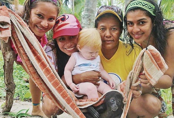El albinismo afecta a 1 de cada 167 personas en la comarca Guna Yala El albinismo afecta a 1 de cada 167 personas en la comarca Guna Yala