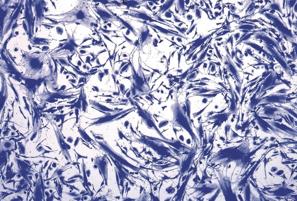 La fotomicrografía 'Self-renewing SARS-CoV-2 positive Placenta-derived MSCs stained with Crystal Violet', de Erika Guerrero, obtuvo el Gran premio del certamen. La fotomicrografía 'Self-renewing SARS-CoV-2 positive Placenta-derived MSCs stained with Crystal Violet', de Erika Guerrero, obtuvo el Gran premio del certamen.