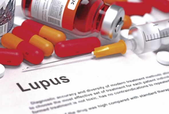 Pacientes con lupus en Panamá contarán con nuevo tratamiento biológico Pacientes con lupus en Panamá contarán con nuevo tratamiento biológico