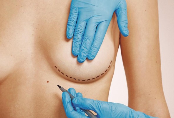 Los procesos más populares son la liposucción, el aumento de busto, la cirugía de párpados, la rinoplastía y abdominoplastía. Los procesos más populares son la liposucción, el aumento de busto, la cirugía de párpados, la rinoplastía y abdominoplastía.