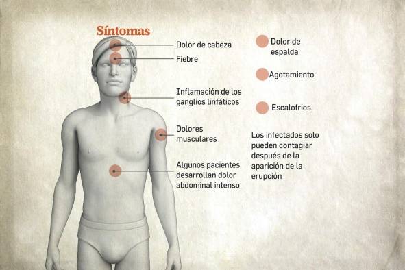 Últimas actualizaciones sobre la viruela del mono en el mundo Últimas actualizaciones sobre la viruela del mono en el mundo
