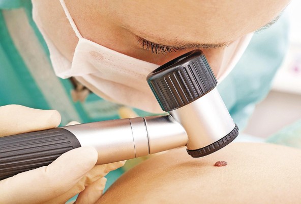 Si nota un lunar nuevo o mancha, o algún cambio en un lunar anterior como picazón o sangrado, visite a un especialista para descartar cualquier anormalidad. Si nota un lunar nuevo o mancha, o algún cambio en un lunar anterior como picazón o sangrado, visite a un especialista para descartar cualquier anormalidad.