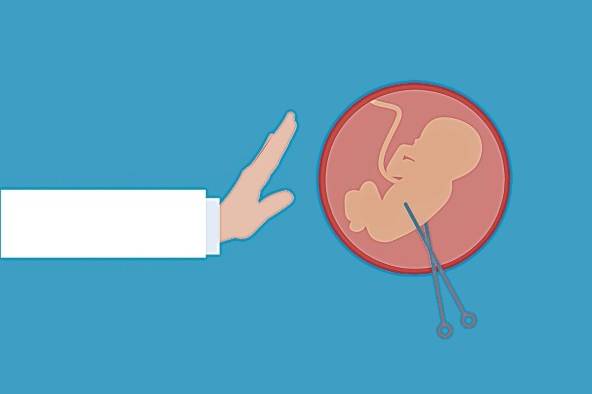 La decisión de esterilizarse puede plantear cuestiones personales y éticas, y para algunas personas no es fácil. La decisión de esterilizarse puede plantear cuestiones personales y éticas, y para algunas personas no es fácil.