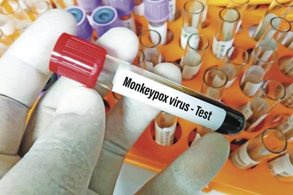 Científicos investigan una vacuna para evitar la propagación de este virus Científicos investigan una vacuna para evitar la propagación de este virus