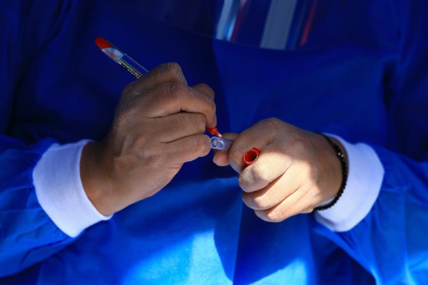 Un trabajador de la Salud realiza una prueba PCR para la detección de la covid-19. Un trabajador de la Salud realiza una prueba PCR para la detección de la covid-19.