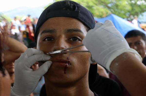Migrantes se cosen la boca para pedir documentos de tránsito en sur de México Migrantes se cosen la boca para pedir documentos de tránsito en sur de México