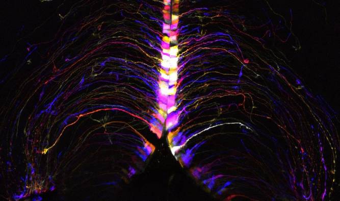 En la imágen, células cerebrales, llamadas tanicitos, iluminadas y codificadas por colores según su profundidad en el hipotálamo cerebral de un ratón. Son uno de los tipos de células del cerebro de ratón que muestran un gran número de transcripciones genéticas que cambian con la edad. Fotografía facilitada por el Instituto Allen. En la imágen, células cerebrales, llamadas tanicitos, iluminadas y codificadas por colores según su profundidad en el hipotálamo cerebral de un ratón. Son uno de los tipos de células del cerebro de ratón que muestran un gran número de transcripciones genéticas que cambian con la edad. Fotografía facilitada por el Instituto Allen.