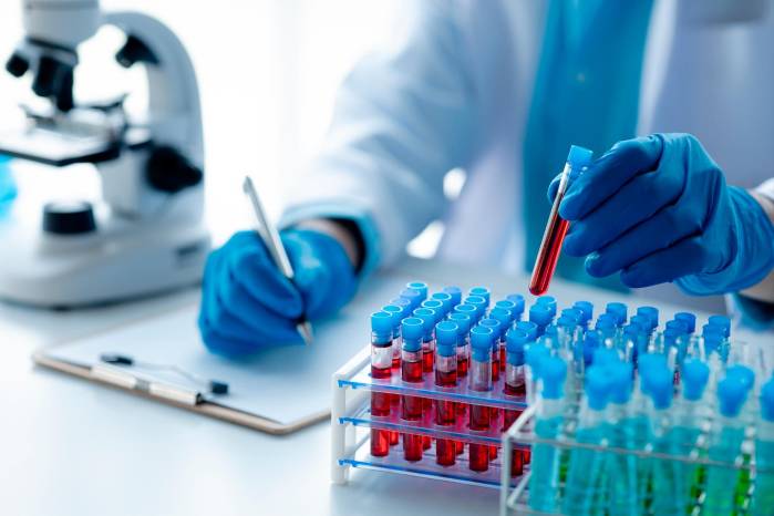 El Minsa ordenó al ICGES aplicar pruebas moleculares a los todos los casos sospechosos. El Minsa ordenó al ICGES aplicar pruebas moleculares a los todos los casos sospechosos.