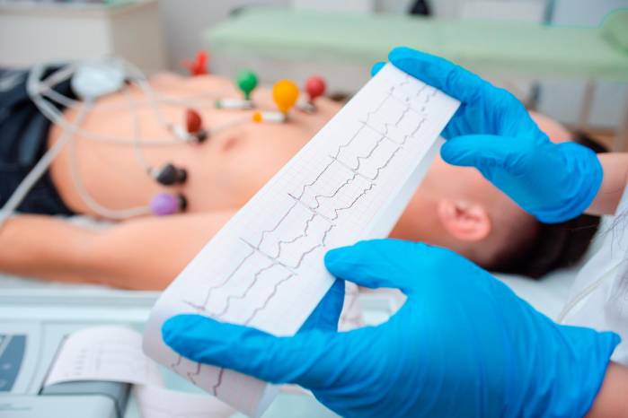 Especialistas aseguran que un electrocardiograma permite detectar problemas del corazón. Especialistas aseguran que un electrocardiograma permite detectar problemas del corazón.