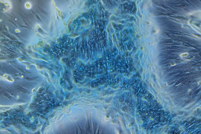 Foto titulada: El Microcosmos de la Condrogénesis. Foto titulada: El Microcosmos de la Condrogénesis.
