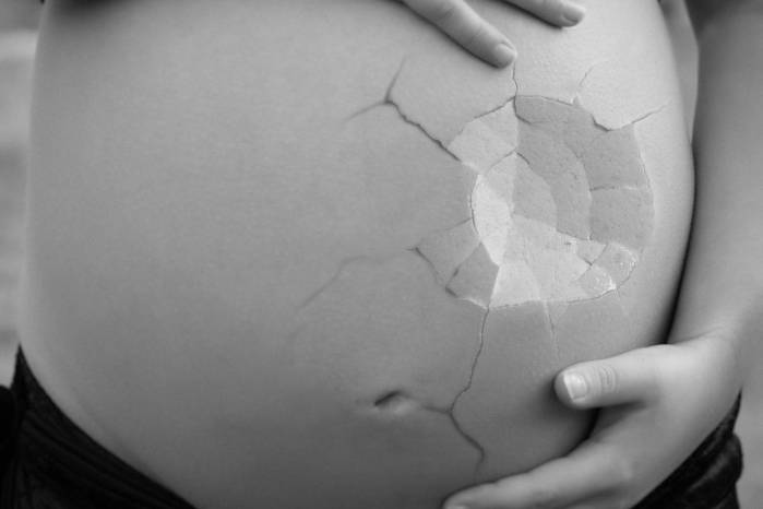 Legalizar el aborto Legalizar el aborto