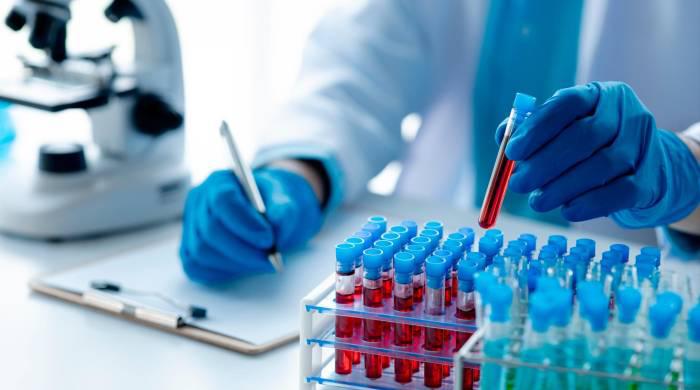 Costa Rica ya se encuentra construyendo un protocolo para abordar la fiebre de Oropouche. Costa Rica ya se encuentra construyendo un protocolo para abordar la fiebre de Oropouche.