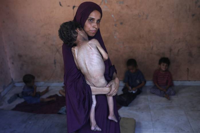 Naeema, una madre palestina de 30 años, carga a su hijo Yazan, de 2 años, desnutrido, mientras permanecen en su casa dañada en el campo de refugiados de Al-Shati, al oeste de la ciudad de Gaza, el 23 de julio de 2025. Naeema, una madre palestina de 30 años, carga a su hijo Yazan, de 2 años, desnutrido, mientras permanecen en su casa dañada en el campo de refugiados de Al-Shati, al oeste de la ciudad de Gaza, el 23 de julio de 2025.