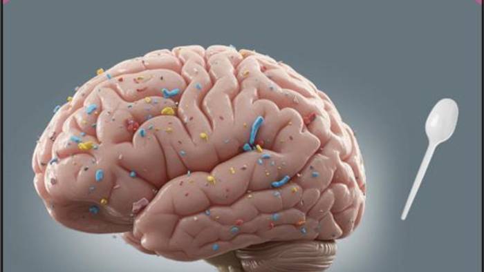 Esta imagen muestra un cerebro humano con coloridas partículas de microplásticos en su superficie. Esta imagen muestra un cerebro humano con coloridas partículas de microplásticos en su superficie.