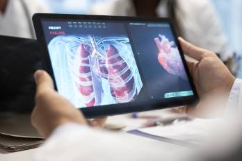 En América Latina, la hipertensión arterial pulmonar afecta principalmente a mujeres jóvenes. El cansancio persistente y la falta de aire son sus primeras señales.