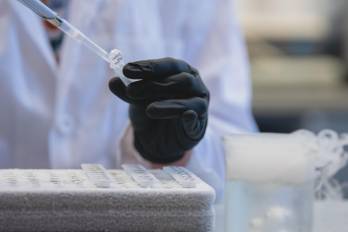 Investigadores demostraron que detener la IDO1 ayuda a restablecer el metabolismo saludable de la glucosa en los astrocitos.