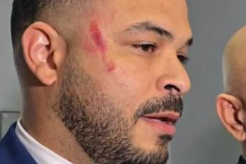 Cedeño dijo que Salazar golpeó a Richards con lentes y sentado.