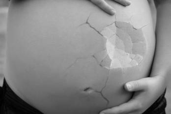 Legalizar el aborto