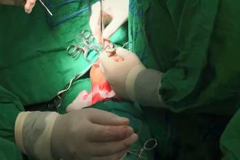 Minsa y CSS activan convocatoria y fijan condiciones para médicos extranjeros