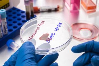Las autoridades italianas confirmaron que cuatro personas que estaban bajo observación por posible exposición al hantavirus dieron negativo en las pruebas realizadas