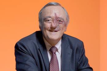 Un equipo de científicos españoles, liderado por el oncólogo Mariano Barbacid, ha conseguido un avance sin precedentes en la lucha contra el cáncer de páncreas.