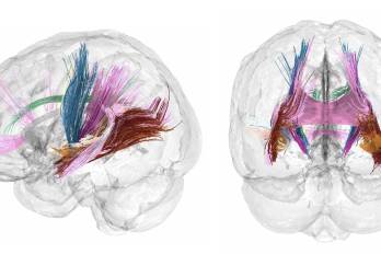El volumen de materia gris cortical se reduce conforme avanza un embarazo. Los colores más oscuros indican las regiones que más reducen el volumen de materia gris durante la gestación.