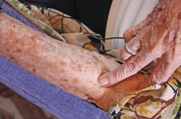 Gerti Zentner, de 96 años, nacida en Praga en 1923, muestra en su brazo izquierdo el numero 72896 que le tatuaron los nazis.