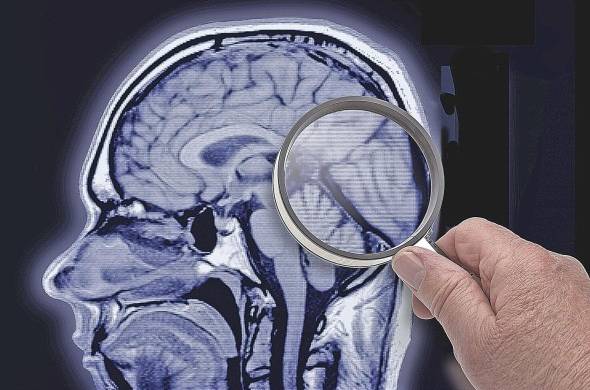 La demencia es un síndrome que implica el deterioro de la memoria, el intelecto, el comportamiento y la capacidad para realizar actividades