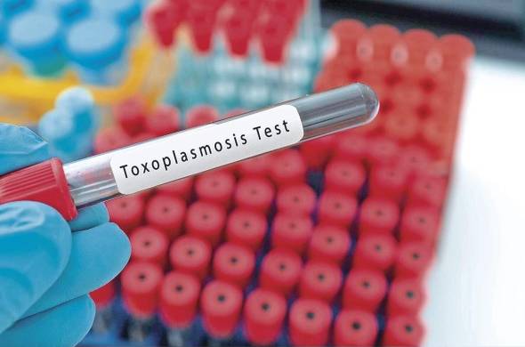 La toxoplasmosis es una infección producida por el parásito 'Toxoplasma gondii'.