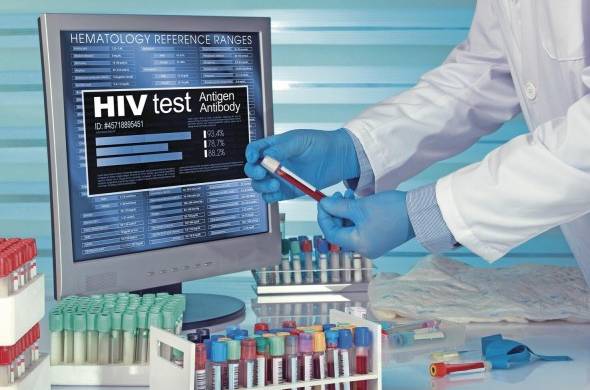 En Panamá por ejemplo, para el primer semestre de 2020, el departamento de epidemiología del Ministerio de Salud registró 287 nuevos casos de VIH.
