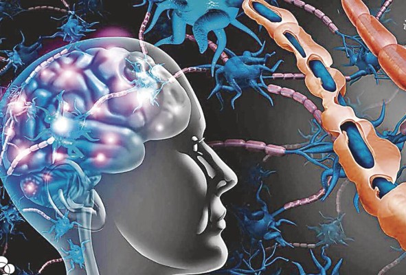 En la esclerosis múltiple, la comunicación nerviosa entre el cerebro y el resto del cuerpo se deteriora con el tiempo.