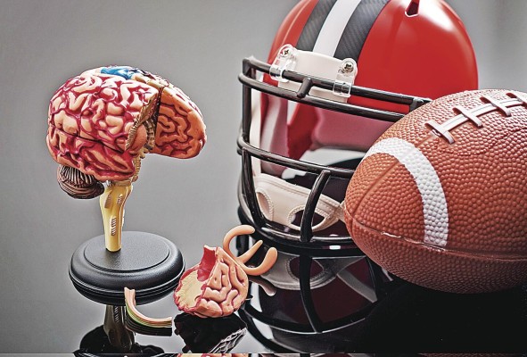 Solo en la NFL se reportaron 44 conmociones cerebrales graves, la temporada pasada.