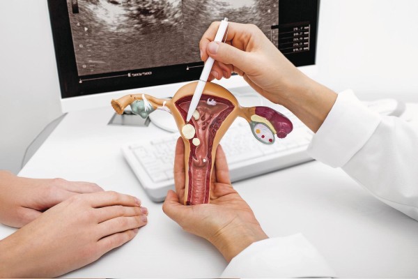 Para las mujeres portadoras de una variante genética de alto riesgo de cáncer de ovario, puede indicarse la extirpación de ovarios antes de la menopausia