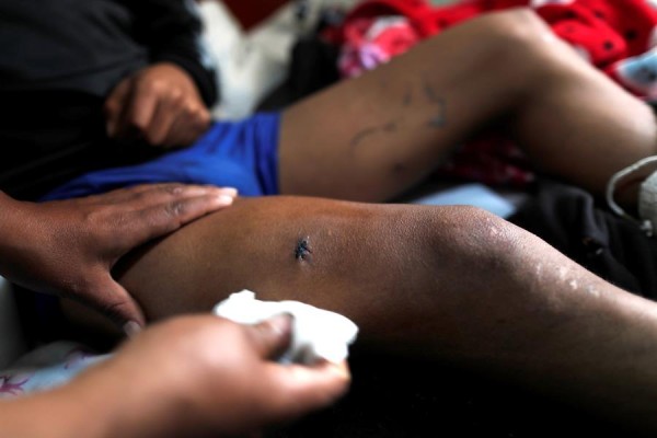 Lisiados, tuertos y muertos: las secuelas de la represi&oacute;n en Ecuador