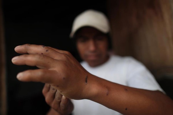 Lisiados, tuertos y muertos: las secuelas de la represi&oacute;n en Ecuador