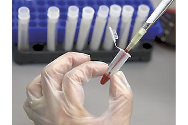 Los adolescentes entre 15 y 19 años están más propensos al contagio del VIH.