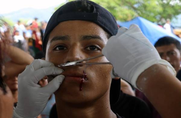 Migrantes se cosen la boca para pedir documentos de tránsito en sur de México