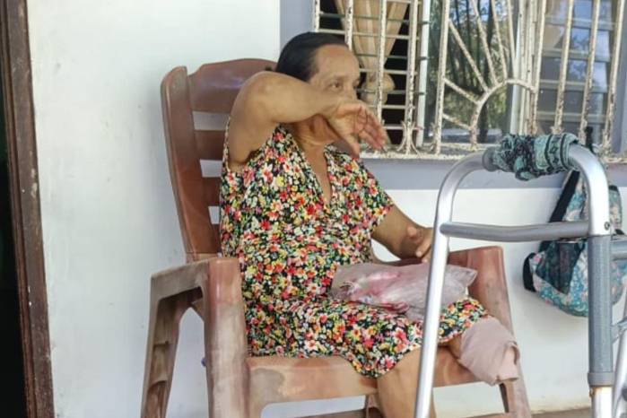 La vecina relató que Barría se mantuvo consciente durante parte de la emergencia.