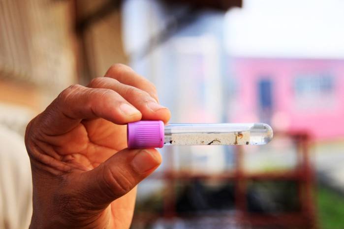 Hasta la semana epidemiológica N.º 38, correspondiente al 20 al 26 de septiembre de 2026, se contabilizaron 9,679 casos en el país, frente a los 12,101 registrados durante el mismo período del año anterior.